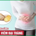 Bật mí cách dùng gừng để giảm viêm đại tràng đơn giản tại nhà