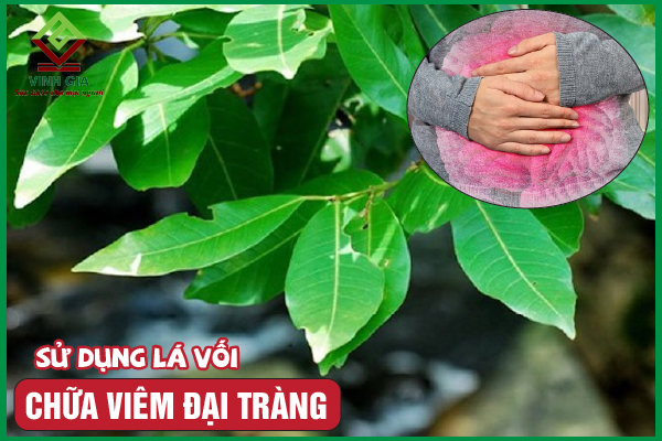 Cách dùng lá vối để giảm viêm đại tràng đơn giản ngay tại nhà