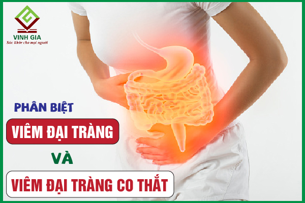 Hướng dẫn cách phân biệt viêm đại tràng và đại tràng co thắt