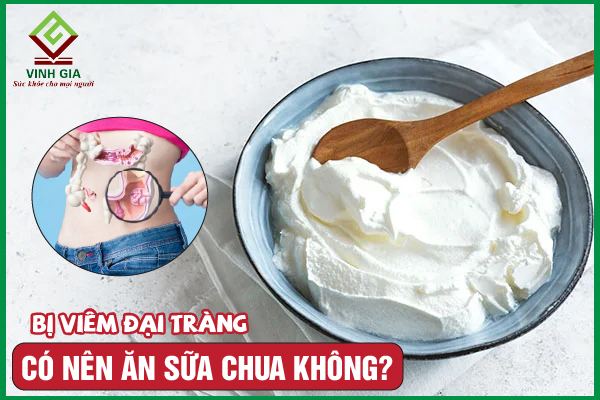 [GIẢI ĐÁP] Viêm đại tràng có nên ăn sữa chua không?
