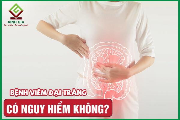 [GIẢI ĐÁP] Bệnh viêm đại tràng có nguy hiểm không?