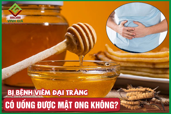 Người bệnh viêm đại tràng có uống mật ong được không?