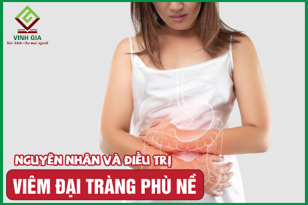 Viêm đại tràng phù nề: Nguyên nhân, dấu hiệu và cải thiện