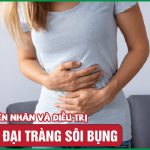 Viêm đại tràng sôi bụng: Nguyên nhân, dấu hiệu và cải thiện