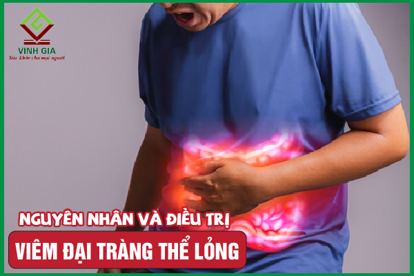 Viêm đại tràng thể lỏng: Nguyên nhân, dấu hiệu và cải thiện
