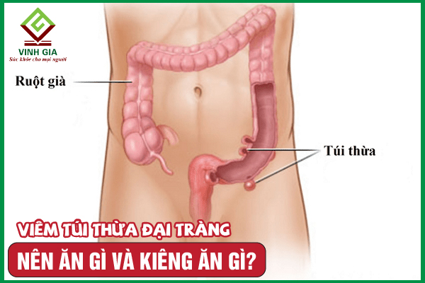 Người bị viêm túi thừa đại tràng nên ăn và kiêng ăn gì?