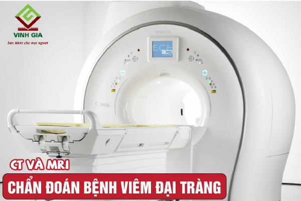 Xét nghiệm chẩn đoán viêm đại tràng nhờ phương pháp MRI và CT scan