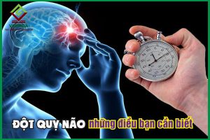 Đột quỹ não: Những điều bạn cần biết về căn bệnh nguy hiểm này