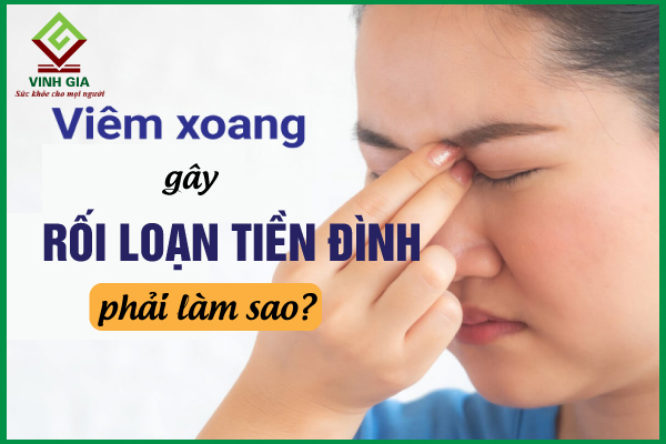 Chớ chủ quan khi viêm xoang gây rối loạn tiền đình