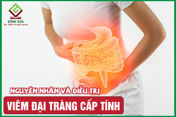 Viêm đại tràng cấp tính: Nguyên nhân và cách cải thiện bệnh