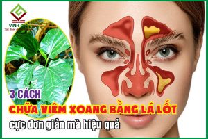 3 cách chữa viêm xoang bằng lá lốt hiệu quả lại dễ áp dụng