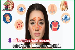 8 biến chứng viêm xoang thường gặp mà người bệnh chớ chủ quan