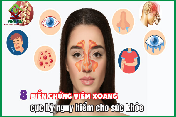 8 biến chứng viêm xoang thường gặp người bệnh chớ chủ quan