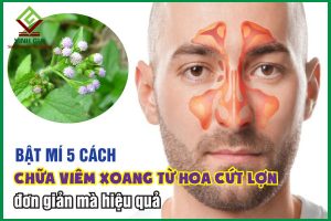 Bật mí 5 bài thuốc từ hoa cứt lợn chữa viêm xoang hiệu quả