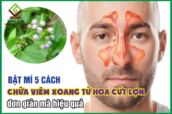 Bật mí 5 bài thuốc từ hoa cứt lợn chữa viêm xoang hiệu quả