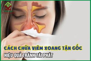 Cách chữa trị viêm xoang tận gốc ngăn ngừa tái phát