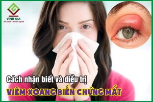 Cách nhận biết và điều trị viêm xoang biến chứng mắt