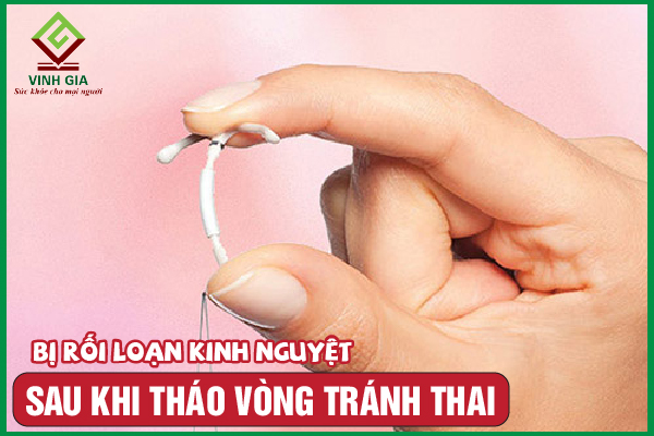 Rối loạn kinh nguyệt sau khi tháo vòng: Cần phải làm gì?
