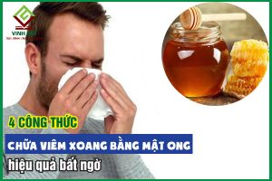 4 công thức chữa viêm xoang bằng mật ong hiệu quả bất ngờ