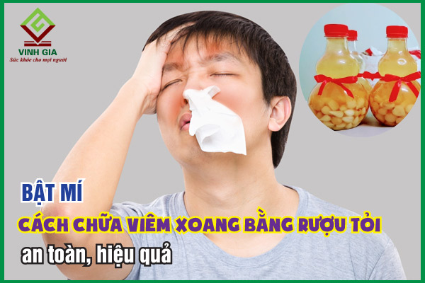 Bí quyết chữa viêm xoang bằng rượu tỏi hiệu quả nhất