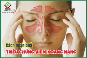 Cách nhận biết các triệu chứng viêm xoang nặng và biến chứng nguy hiểm