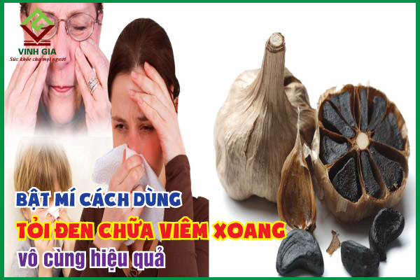 Cách sử dụng tỏi đen chữa viêm xoang không phải ai cũng biết