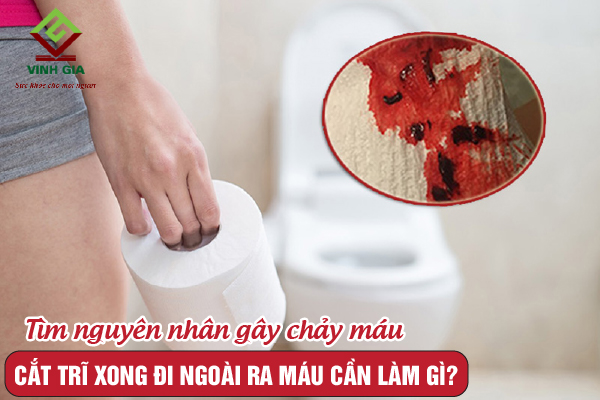 Cần tìm nguyên nhân chảy máu khi bị đi ngoài ra máu sau mổ trĩ