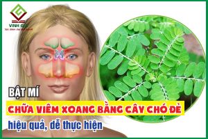 Chữa viêm xoang bằng cây chó đẻ đơn giản, dễ thực hiện