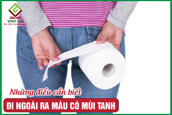 Đi ngoài ra máu có mùi tanh là cảnh báo của bệnh gì?