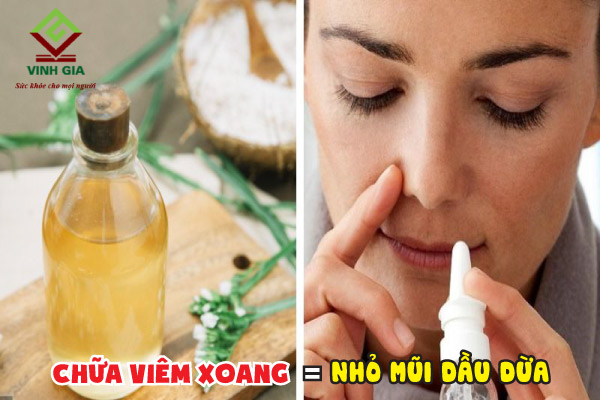 Nhỏ mũi bằng dầu dừa để chữa viêm xoang được nhiều người áp dụng
