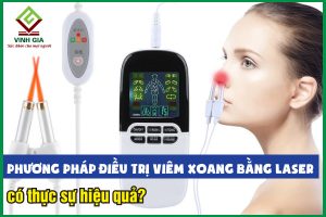 Phương pháp điều trị viêm xoang bằng laser có hiệu quả không?