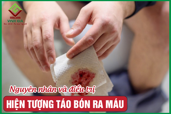Táo bón ra máu: Nguyên nhân, dấu hiệu và cách khắc phục
