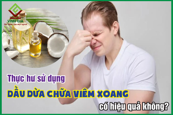 Thực hư sử dụng dầu dừa chữa viêm xoang có hiệu quả thật không?