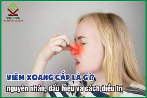 Viêm xoang cấp: Nguyên nhân, triệu chứng và cách điều trị