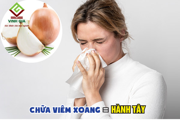Chữa viêm xoang mũi bằng hành tây giúp làm giảm nguy cơ tái nhiễm viêm xoang