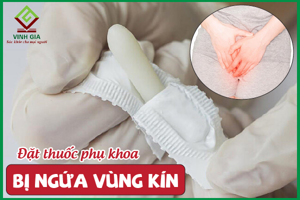 Cách xử lý sau khi đặt thuốc phụ khoa bị ngứa vùng kín