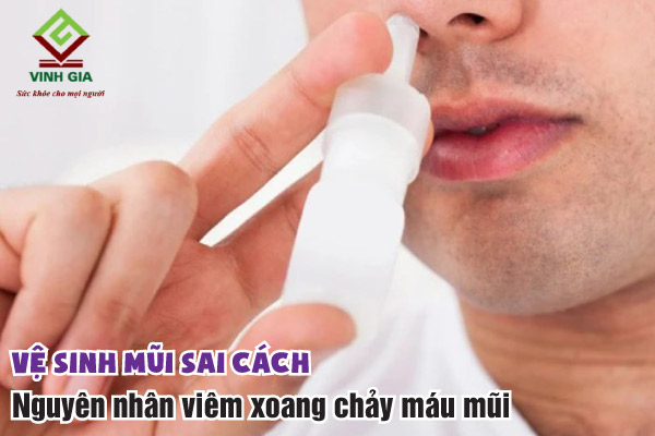 Vệ sinh mũi sai cách có thể là nguyên nhân của viêm xoang mũi ra máu