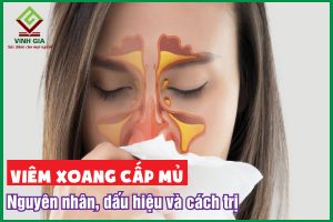 Viêm xoang cấp mủ: Nguyên nhân, triệu chứng và cách điều trị