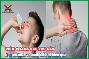 Viêm xoang đau sau gáy: Nguyên nhân và cách điều trị hiệu quả