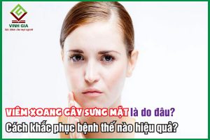 Viêm xoang gây sưng mặt và cách cải thiện bệnh hiệu quả