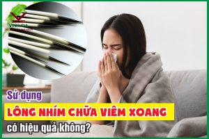 Dùng lông nhím chữa viêm xoang và những điều cần lưu ý