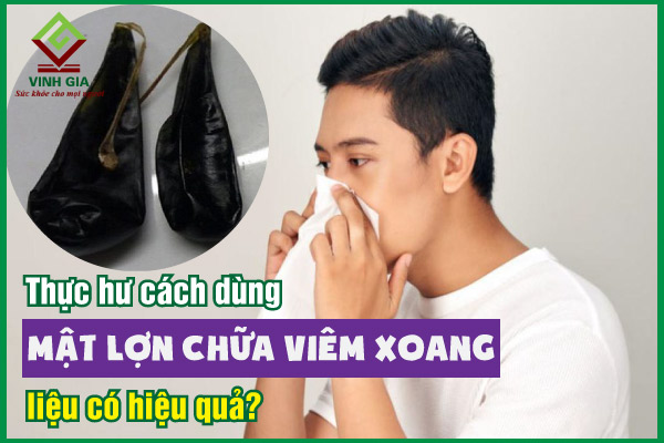 Thực hư dùng mật lợn chữa viêm xoang có hiệu quả không?