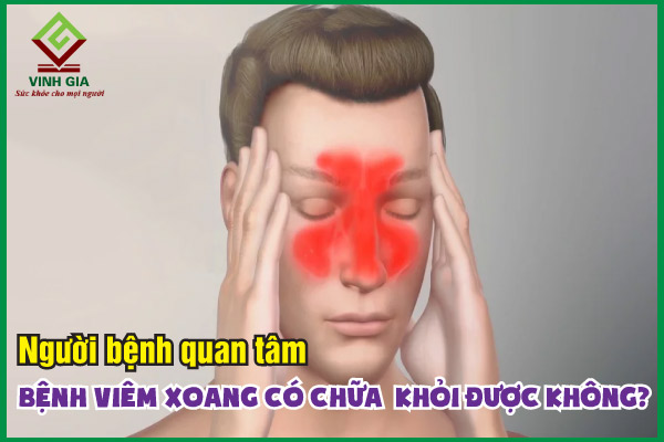 Liệu viêm xoang có chữa khỏi được không? 