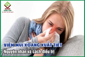 Nguyên nhân gây viêm mũi xoang xuất tiết và cách điều trị