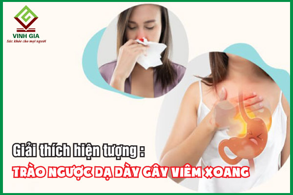 Trào ngược dạ dày gây viêm xoang thế nào? Cách điều trị an toàn