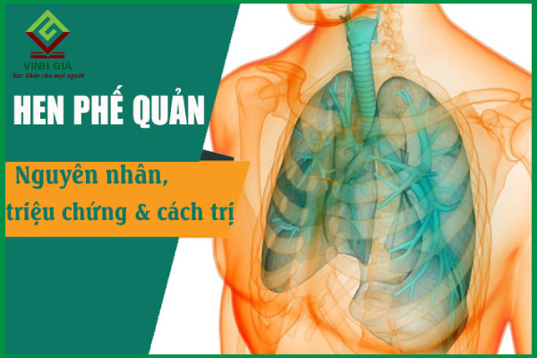 Hiểu đúng về hen phế quản để phòng và điều trị hiệu quả
