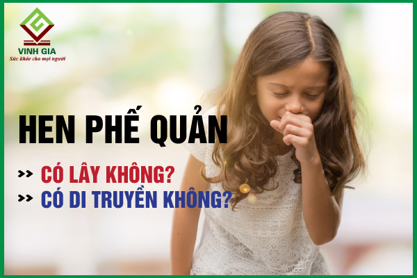 Hen phế quản có lây không, có di truyền không?