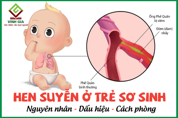 4 nguyên nhân gây hen suyễn ở trẻ sơ sinh và cách trị