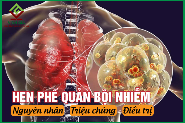 Cách điều trị và phòng hen phế quản bội nhiễm