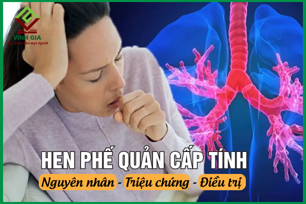 Hen phế quản cấp và cách xử trí kịp thời